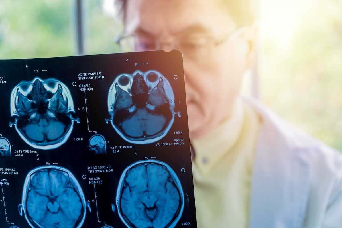 Doctor with a brain scan